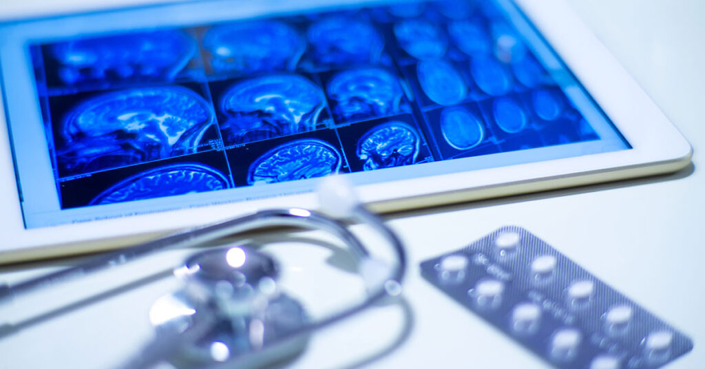 Como a Neuroftalmologia pode ajudar a diagnosticar e tratar doenças neurológicas que afetam a visão