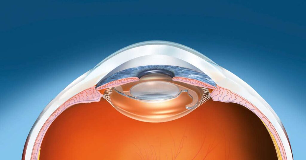 Como Se Preparar para a Cirurgia de Catarata: Dicas Essenciais