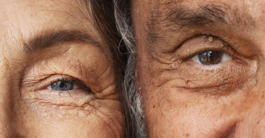 Prevenção da catarata: dicas para manter a saúde dos olhos
