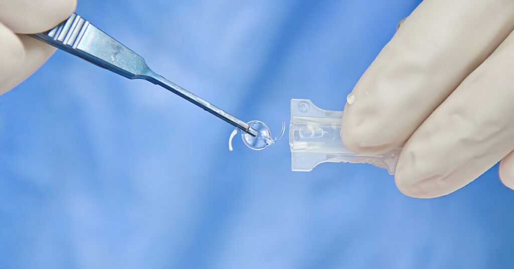 Implante de Lente Intraocular A Evolução dos Tratamentos para Catarata